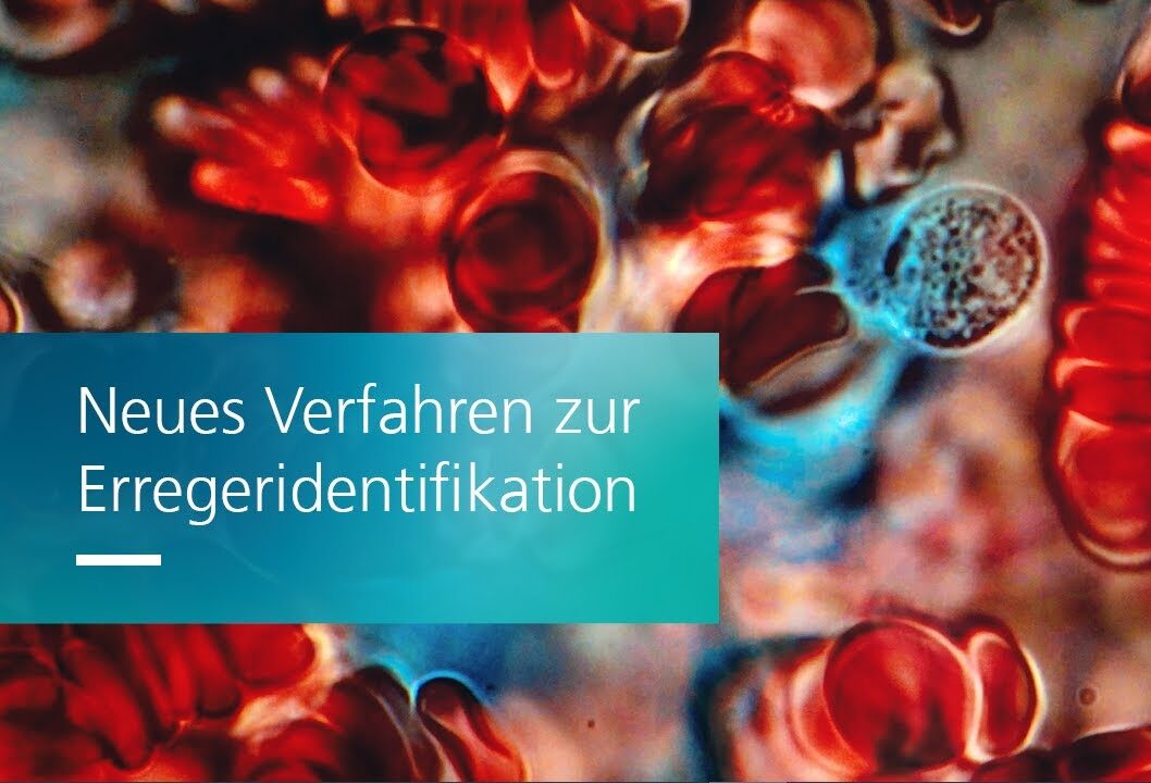 Fortschritt im Kampf gegen Sepsis