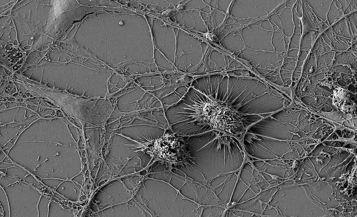 Immunzellen im Gehirn schützen Neuronen per Tunnel