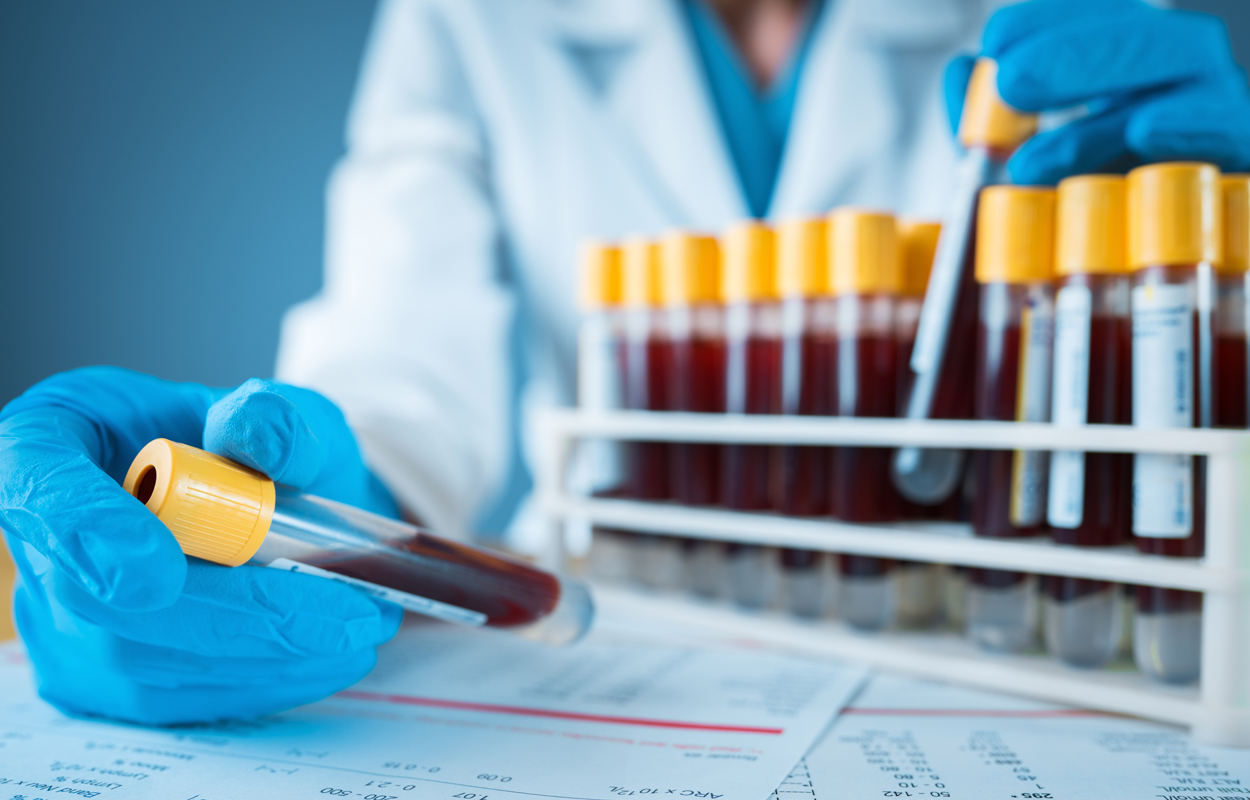 Proteine im Blut verraten Alter unseres Gehirns