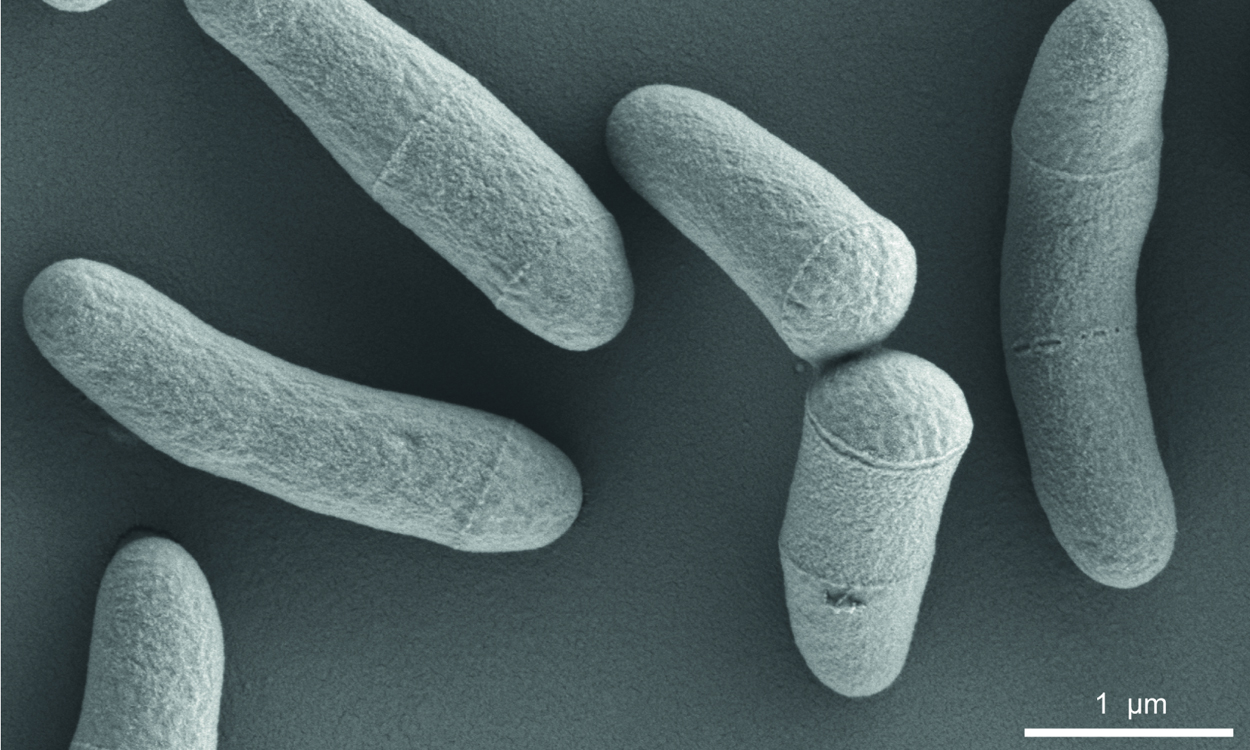 Glutamat-Produzent ist Mikrobe des Jahres 2025