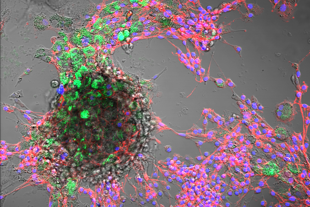 Nanoplastik auch in Nutztierzellen