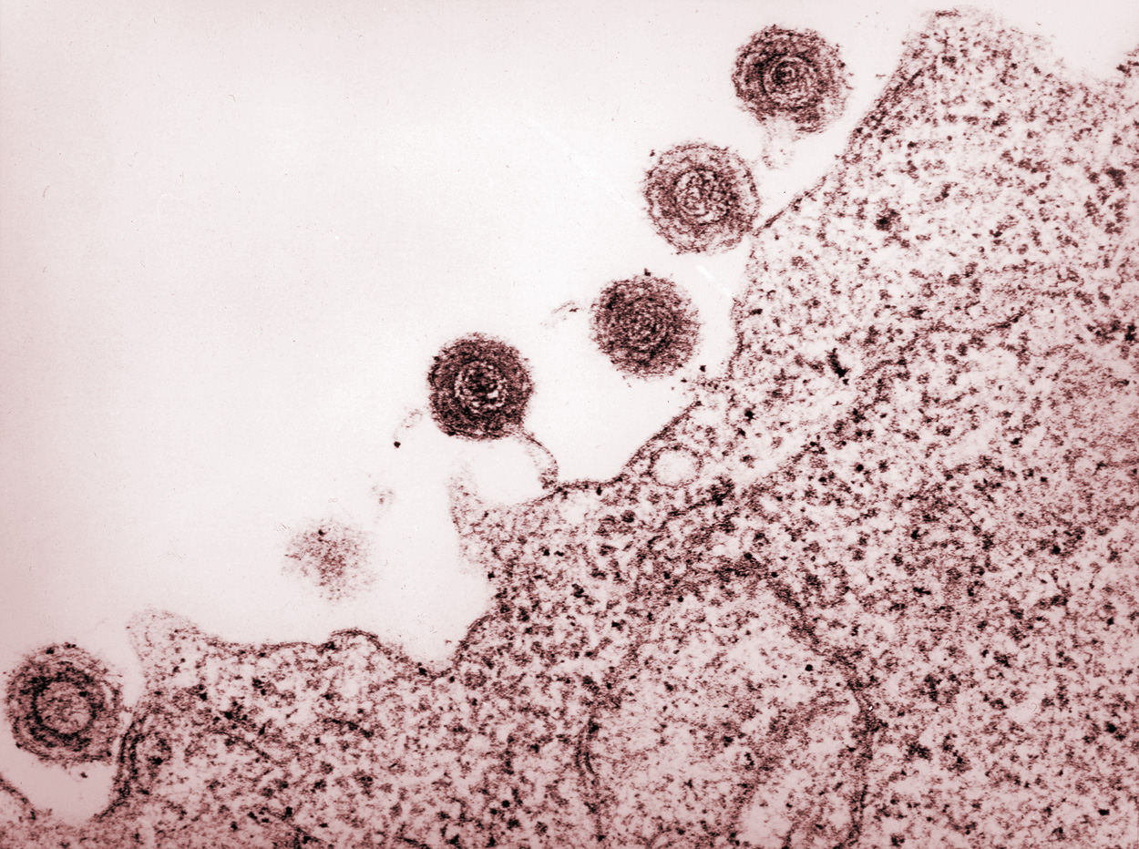 Herpesviren schon vor 2500 Jahren im menschlichen Genom