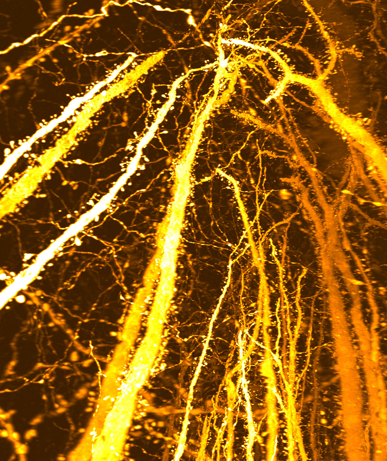 Dendriten
