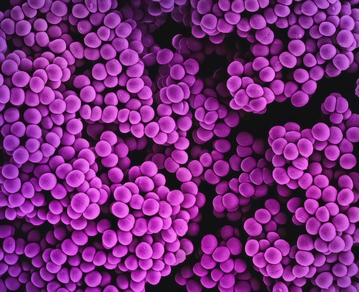 MRSA-Bakterien