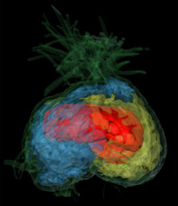 CT-Scan