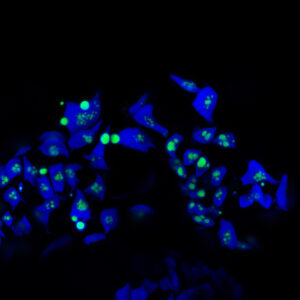 Mikroskopieaufnahme von fluoreszierenden Pyrenoiden aus Hornmoos