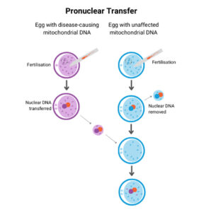 Grafik erklärt den Ablauf des Vorkern-Transfers
