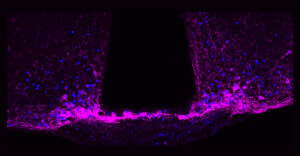 Fluoreszenzmarkierte Neuronen