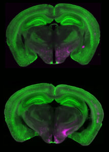 Fluoreszenzmarkierte Neuronen