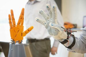 Handprothese
