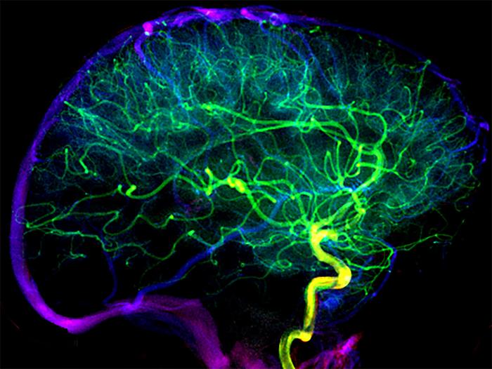 Arterienverbindungen verbessern Schlaganfall-Regeneration