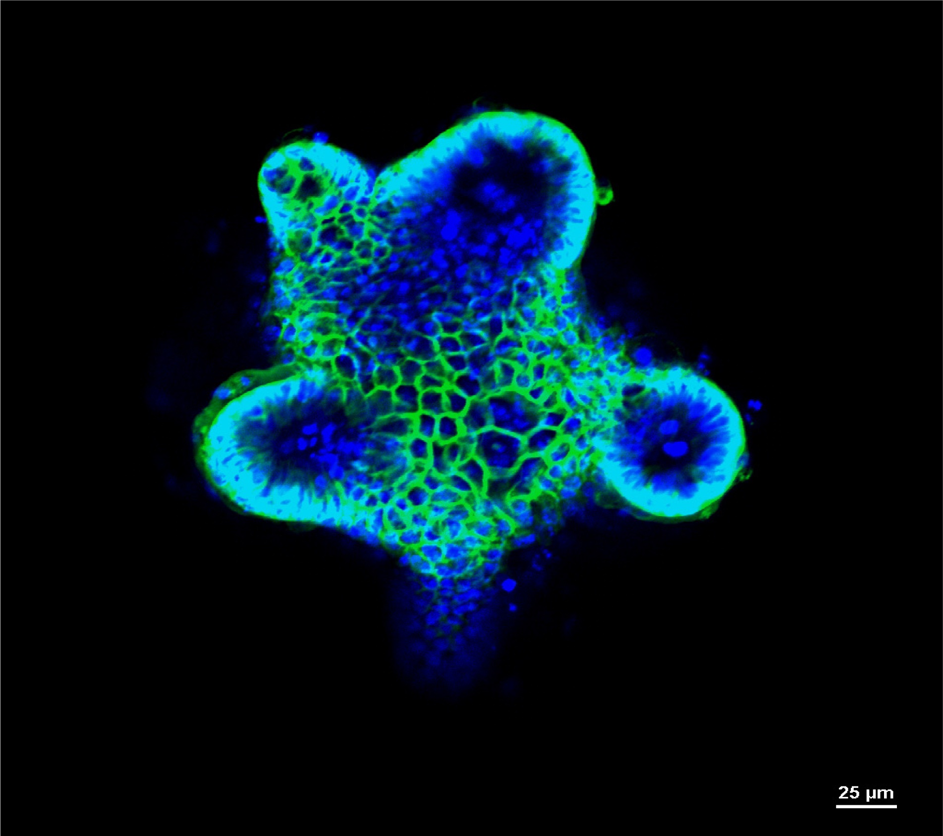 Ein Organoid, das die biologischen Eigenschaften des menschlichen Darmes hat.
