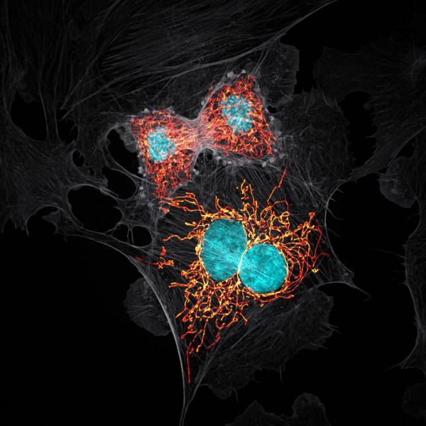 Rinder-Arterienzellen Mitose