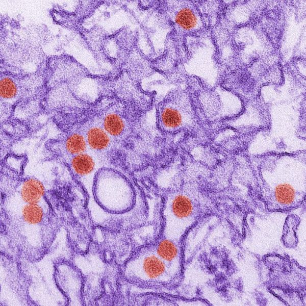 Zika-Virus