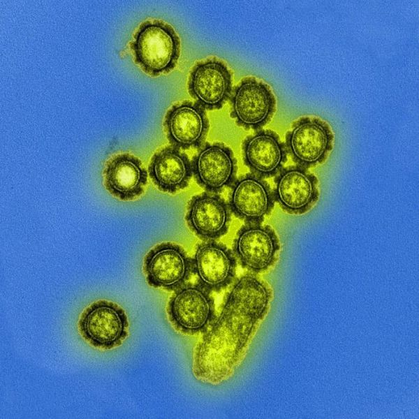 H1N1 Influenzavirus
