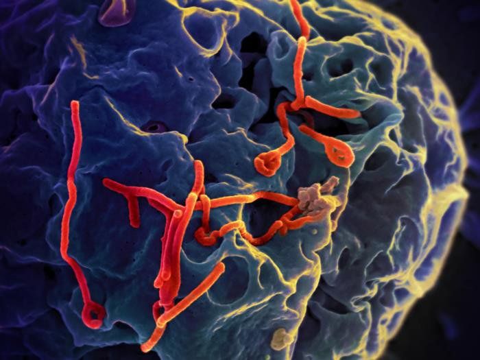 Ebola-Virus