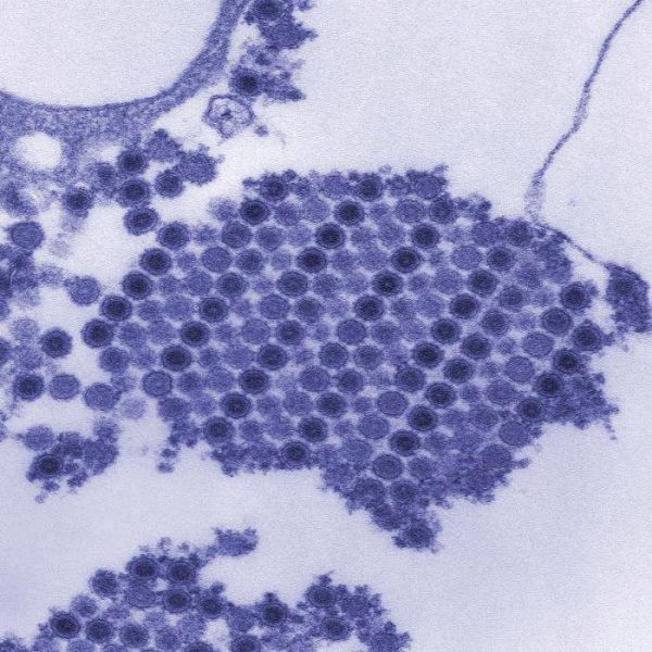 Chikungunya-Virus