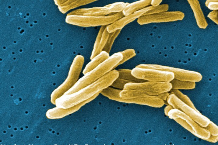 Tuberkulose: Treuer Begleiter seit 70.000 Jahren