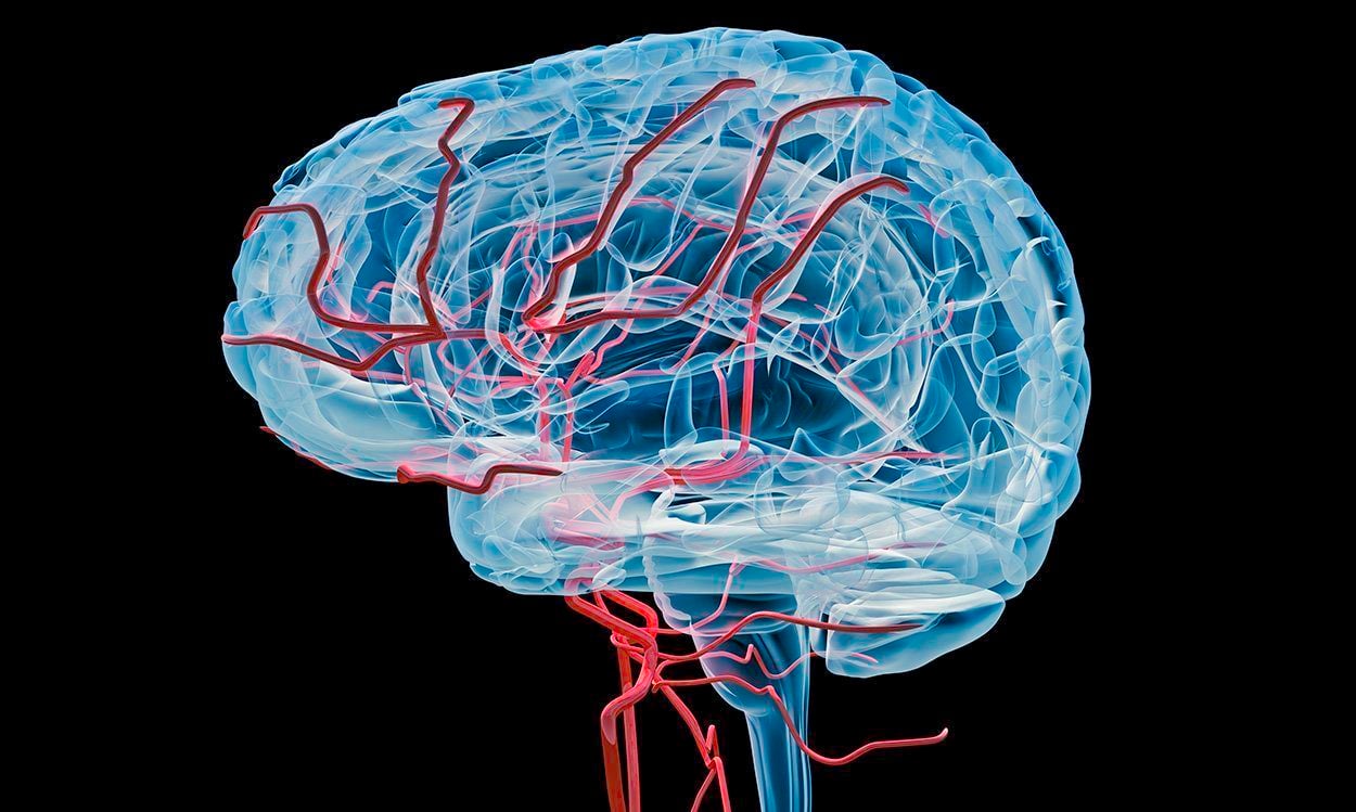 Neue Daten zu Sinusvenenthrombosen