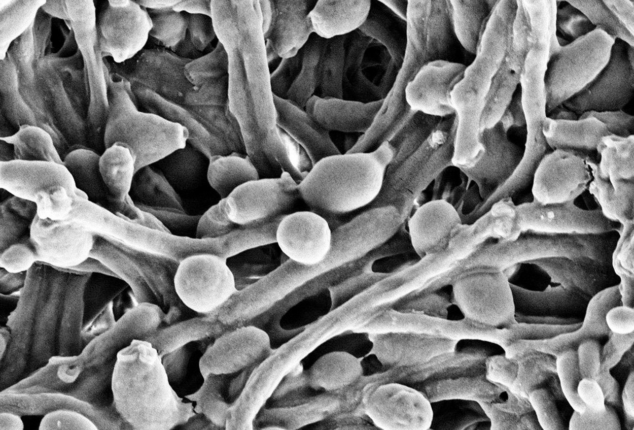 Wie Pilze und Immunsystem im Darm zusammenspielen