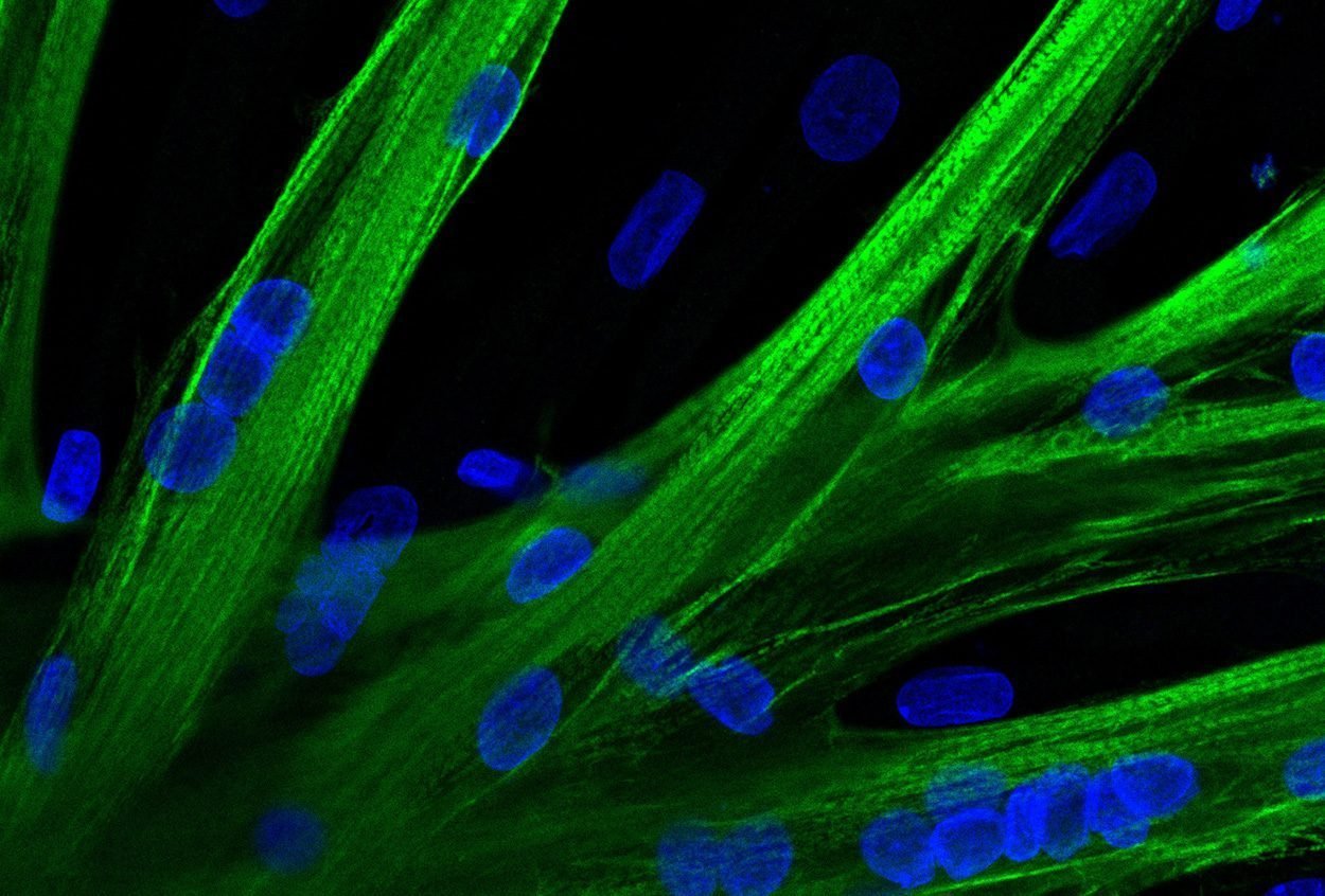 Mit mRNA gegen Muskelschwund