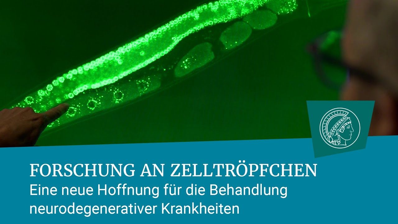 Erstaunliche Zelltröpfchen im Visier